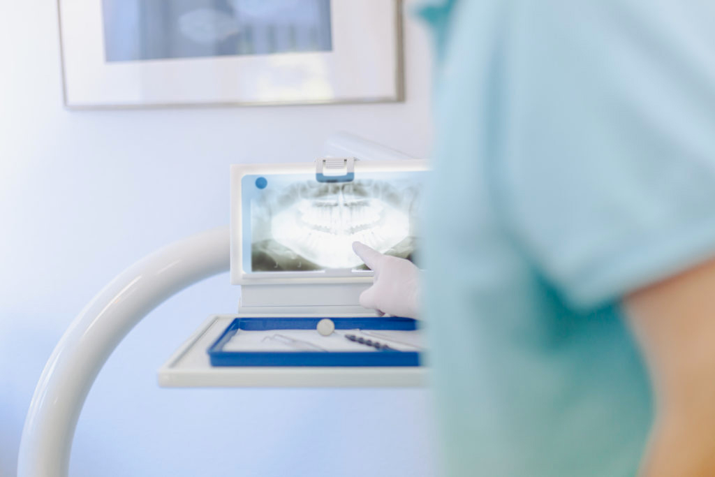 Röntgenaufnahme im Behandlungszimmer